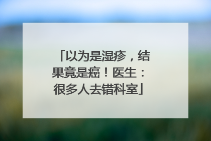 以为是湿疹，结果竟是癌！医生：很多人去错科室